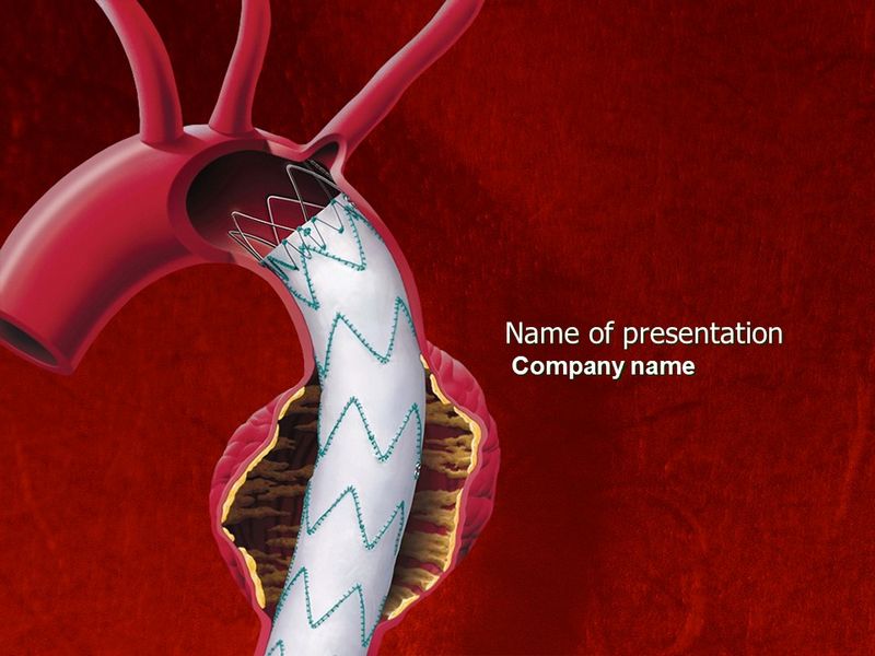 Aortic Aneurysm - Free Google Slides theme and PowerPoint template

