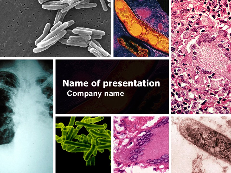 Tuberculosis - Free Google Slides theme and PowerPoint template
